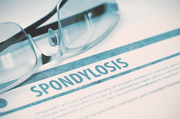 Diagnosztika - Spondylosis. Orvosi koncepció. 3D-s illusztráció. — Stock Fotó