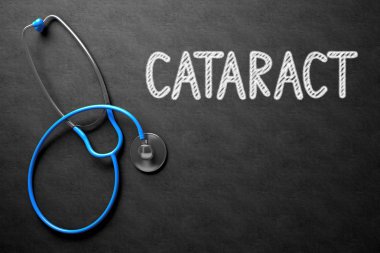 Katarakt ile kara tahta. 3D çizim.