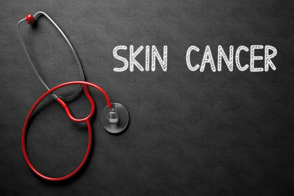 Μαυροπίνακας με την έννοια του καρκίνου του δέρματος. 3D απεικόνιση. — Φωτογραφία Αρχείου
