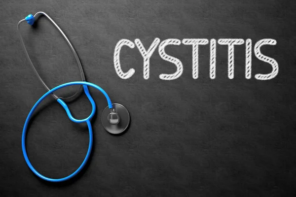 Chalkboard with Cystitis Concept. 3D Illustration. — Stock Image Chalkboard with Cystitis Concept. 3D Illustration. Stock Photo