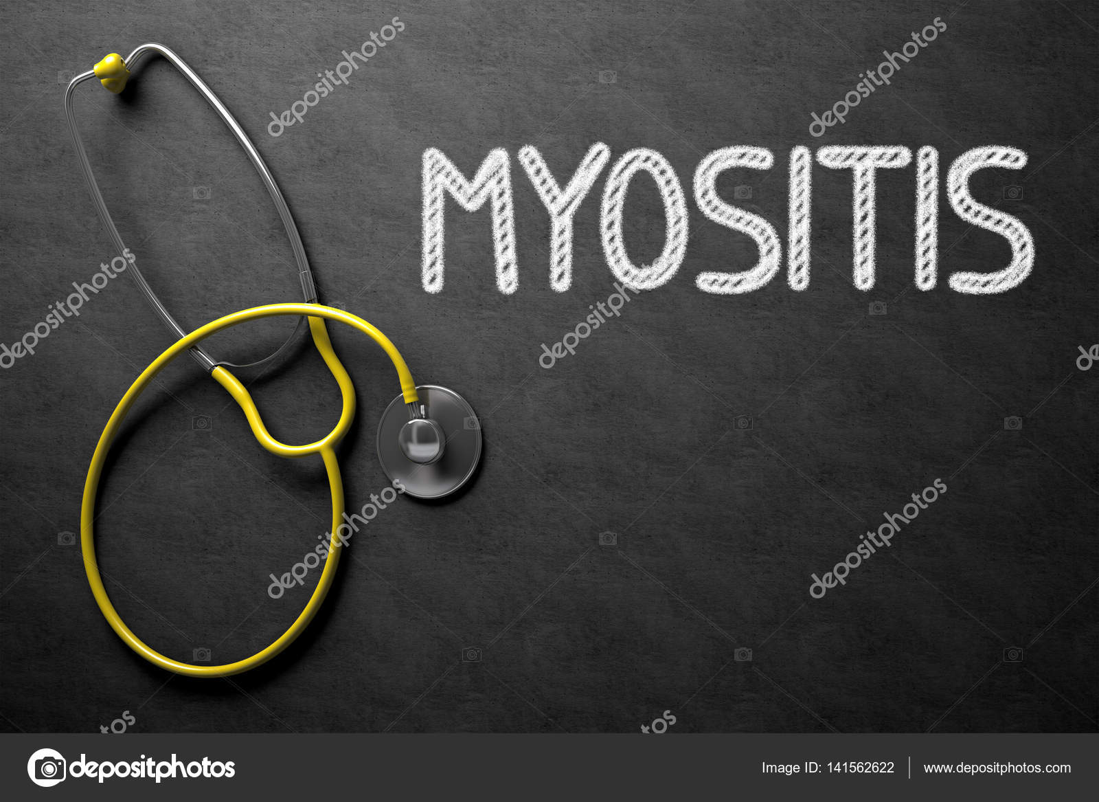 diabetes miositis