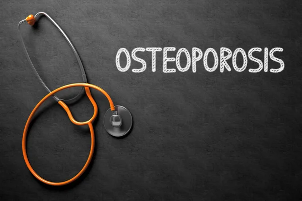 Osteoporos handskriven på svarta tavlan. 3D illustration. — Stockfoto