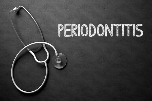 Periodontitis Konsep di Chalkboard. Ilustrasi 3D . — Stok Foto