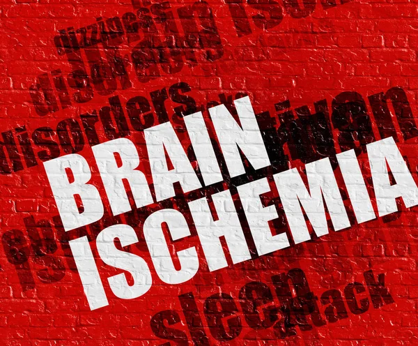 Conceito de saúde moderna: Isquemia Cerebral em Brickwall Vermelho  . — Fotografia de Stock