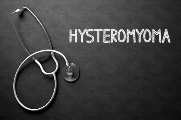 Hysteromyoma koncepció a Palatábla. 3D-s illusztráció. — Stock Fotó