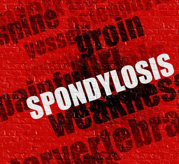 Concepto de salud moderno: Espondilosis en el muro de ladrillo rojo  . — Foto de Stock