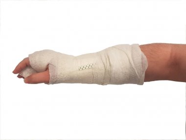 broken hand plaster. right hand. male. isolated clipart