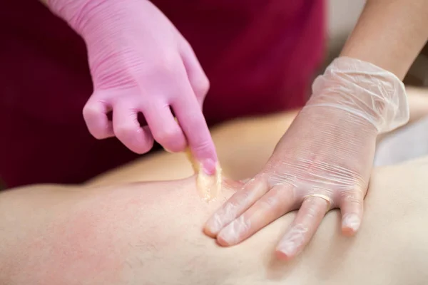 Primer plano esteticista elimina el cabello no deseado del pecho del hombre usando pasta de azúcar en el salón de Spa. Depilación masculina. El maestro de la depilación rasga bruscamente la cera del pecho del hombre . — Foto de Stock