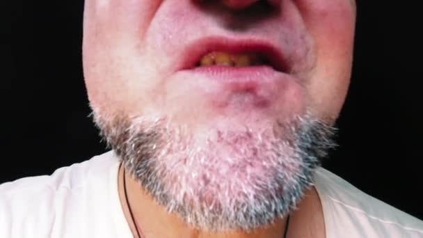 Homme Colère Gros Plan Bouche Homme Avec Les Dents Tordues — Video