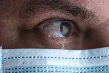 Maskeli ağlayan erkek doktorun gözlerinde yaşlar. Yüzü yakın plan. Salgın ve virüs salgını. Coronavirus covid-19. Gözyaşları. 