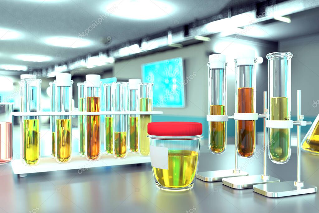 Urine sample test for nitrite or tyrosine - lab proofs in modern biochemistry facility, medical 3D illustration