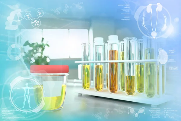 Urine sample test for urobilinogen or diabetes - test tubes in modern biotechnology university office, medical 3D illustration