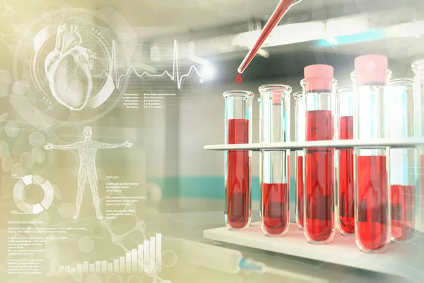Biyolojik tesiste kanıtlar - monosit veya kolesterol için kan örneği DNA testi, yaratıcı kaplamalı tıbbi 3D illüstrasyon