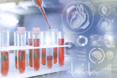 İlaç kliniğinde test tüpleri - kalsiyum veya fosfor için kan testi, yaratıcı gradyan kaplamalı tıbbi 3D illüstrasyon