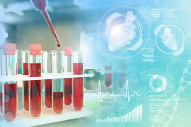 Tıbbi klinikte test tüpleri - eozinofil veya HIV için kan testi, yaratıcı kaplamalı tıbbi 3D illüstrasyon
