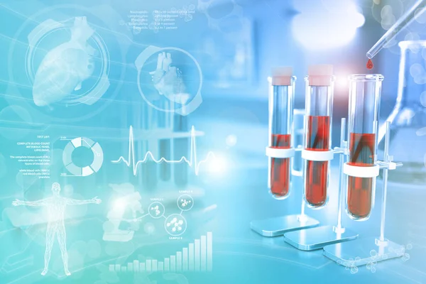 Tubos Ensaio Escritório Química Teste Dna Amostra Sangue Para Cálcio — Fotografia de Stock