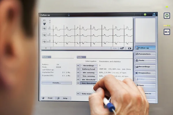 医生心脏起搏器监视器 — 图库照片