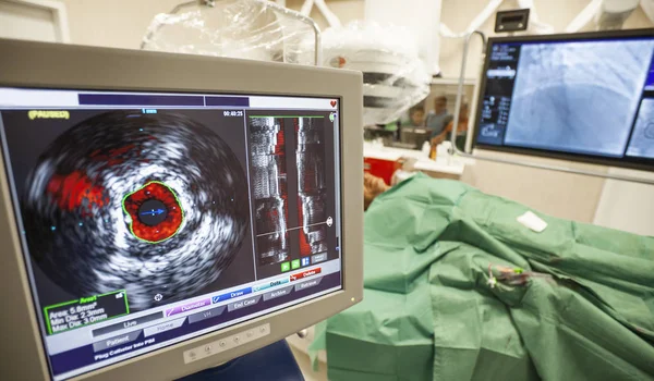 Cirurgia laparoscópica monitora hospital cardíaco — Fotografia de Stock