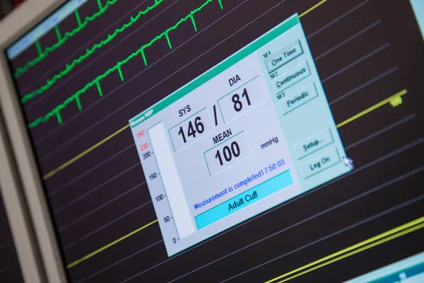 Tepové frekvence Monitor krevního tlaku — Stock fotografie