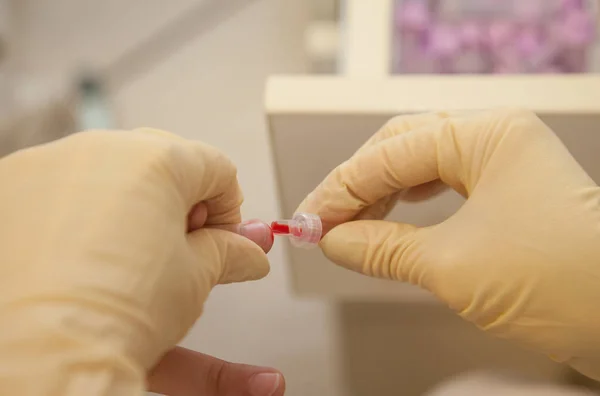 Blood Sample Finger — Stock Photo, Image