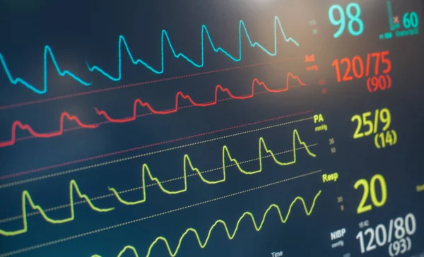 Монітор частоти серцевих скорочень — стокове фото
