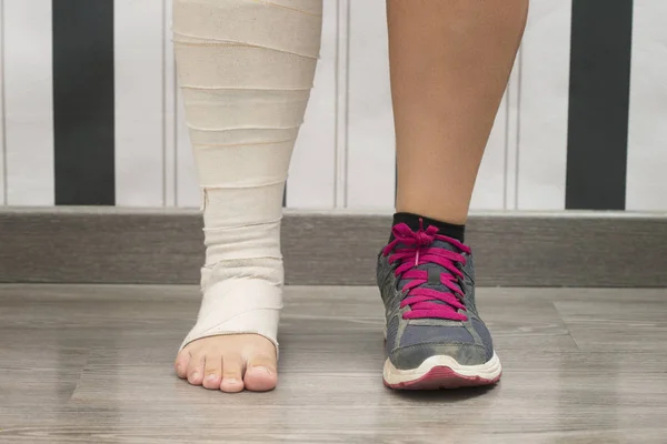 Mujer deportiva lesionada —  Fotos de Stock