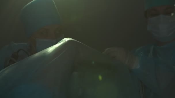 Der Prozess der gynäkologischen Chirurgie eines jungen Mädchens, ein Team von Fachleuten, die eine Operation durchführen. — Stockvideo