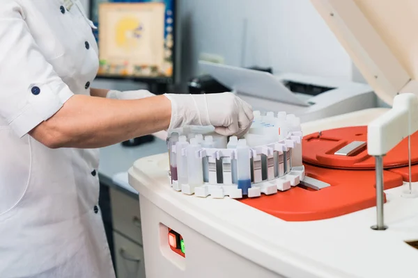 医療機器 実験室ウイルスを検査するための機械の血液検査管 ストック写真