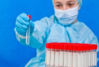 Mavi arka planda test tüpü tutan bir kadın doktor. Coronavirus testi