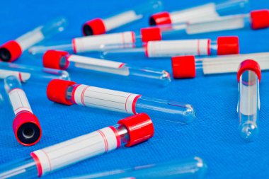 Test tüpleri analiz için mavi arkaplan üzerinde boş