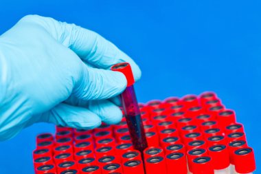 Kauçuk eldivenli eller test tüpünde kan tutuyor. Yakın çekim..