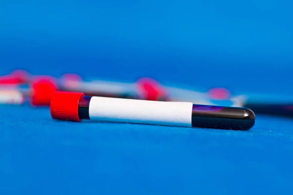 Closeup Tubo Teste Sangue Com Adesivo Branco Para Resultado Rótulo — Fotografia de Stock