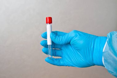Gri arkaplandaki analizleri toplamak için elinde boş bir test tüpü bulunan tek kullanımlık mavi eldivenleri teslim et.