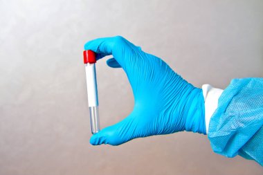 Gri arkaplandaki analizleri toplamak için elinde boş bir test tüpü bulunan tek kullanımlık mavi eldivenleri teslim et.