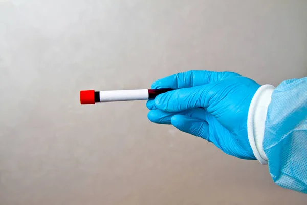 Mão Azul Luvas Borracha Descartáveis Médicos Segurando Tubo Teste Com — Fotografia de Stock