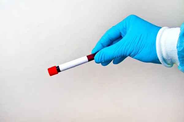 Ręka Niebieskim Medycznym Jednorazowe Gumowe Rękawice Trzymające Probówkę Czerwoną Krwią — Zdjęcie stockowe