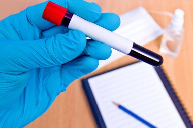 Laboratuvardaki kan örnekleriyle tıbbi çalışmalar için vakum tüpleri. Coronavirus testi. Plastik eldivenli doktor eli.