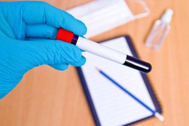 Laboratuvardaki kan örnekleriyle tıbbi çalışmalar için vakum tüpleri. Coronavirus testi. Plastik eldivenli doktor eli.