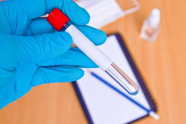 Laboratuvardaki kan örnekleriyle tıbbi çalışmalar için vakum tüpleri. Coronavirus testi. Plastik eldivenli doktor eli.