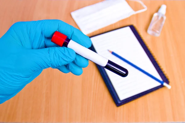 Vakuové Trubice Pro Lékařskou Práci Vzorky Krve Laboratoři Koronavirový Test — Stock fotografie