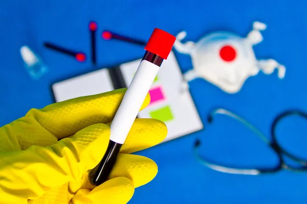 Vakuumrör För Medicinskt Arbete Med Blodprov Laboratoriet Coronavirus Test Läkarens — Stockfoto