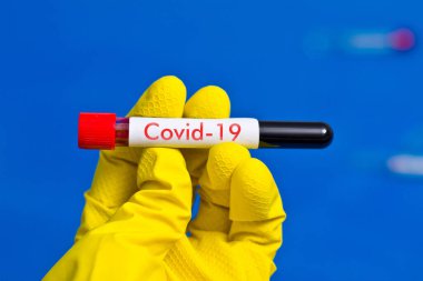 ?Kauçuk eldivenler giyip üzerinde kan olan test tüpü tutuyorlar. Üzerinde COVID-19 yazılıydı..