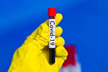 ?Kauçuk eldivenler giyip üzerinde kan olan test tüpü tutuyorlar. Üzerinde COVID-19 yazılıydı..