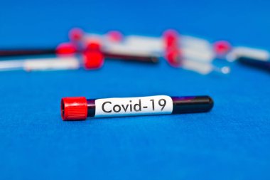 Kan testi tüpü COVID-19 yazısıyla yakın plan..