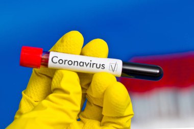?Kauçuk eldivenler giyip üzerinde kan olan test tüpü tutuyorlar. Coronavirus yazısıyla..