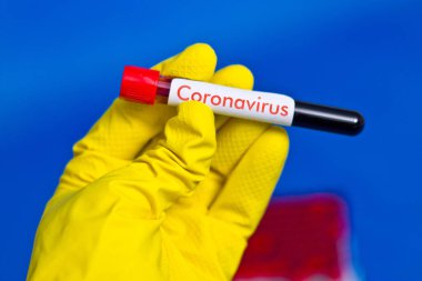 ?Kauçuk eldivenler giyip üzerinde kan olan test tüpü tutuyorlar. Coronavirus yazısıyla..