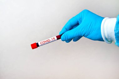 Üzerinde COVID-19 yazan gri arka planda kırmızı kan olan test tüpü taşıyan mavi tek kullanımlık lastik eldivenleri teslim edin.