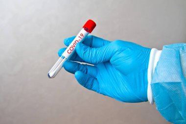 Üzerinde COVID-19 yazan gri bir arkaplan üzerinde analiz için bir tüp bulunan mavi tek kullanımlık lastik eldivenleri teslim edin.