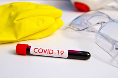 Lastik eldiven ve bardakların arka planında kan örneği var. Örnek Covid-19 yazısıyla birlikte masanın üzerinde..