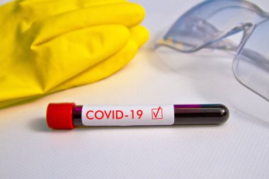 Lastik eldiven ve bardakların arka planında kan örneği var. Örnek Covid-19 yazısıyla birlikte masanın üzerinde..